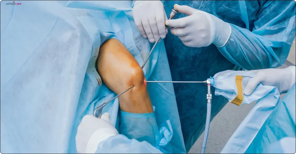 Arthroscopy